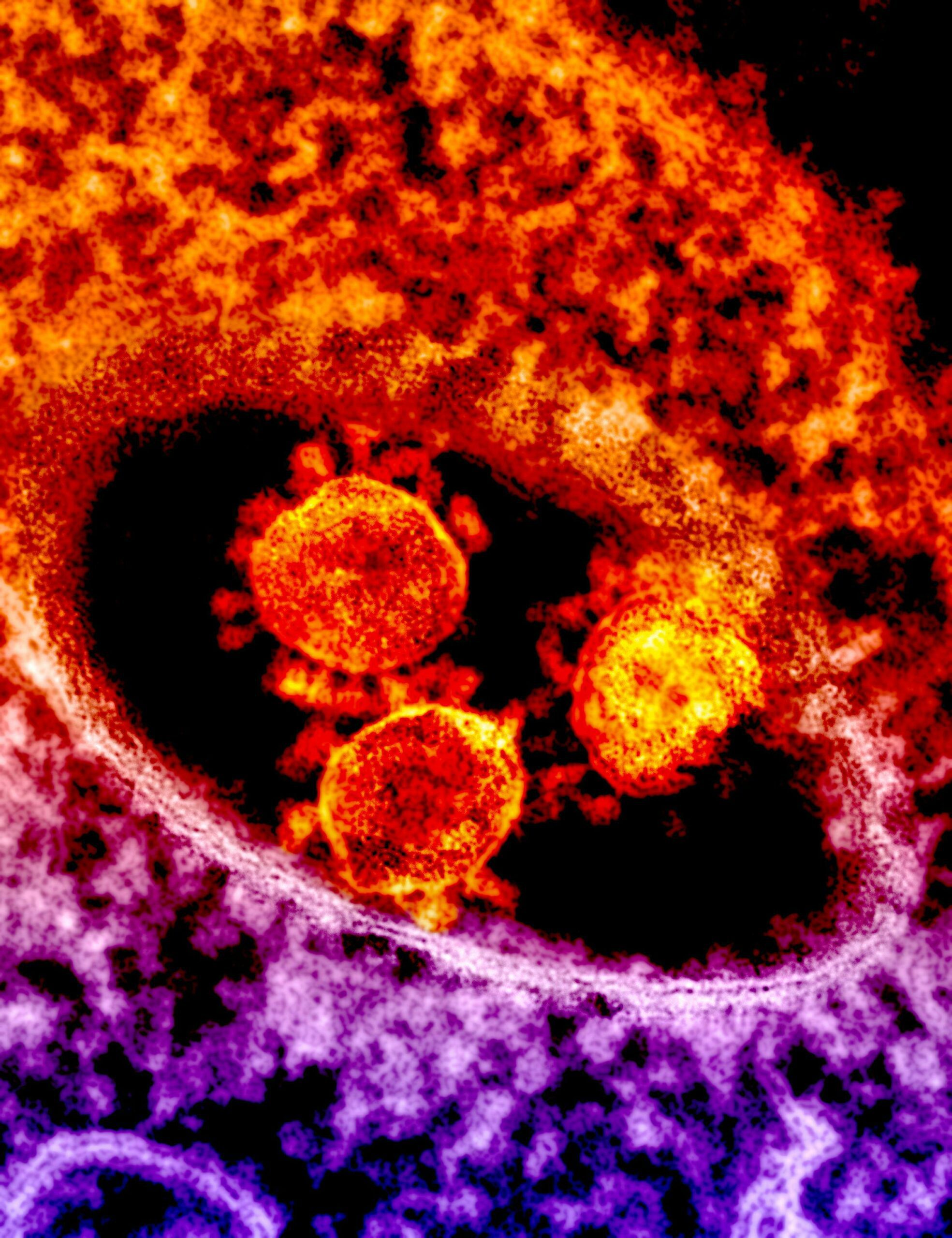 Chlorine dioxide (ClO₂) represents a fundamental shift in sanitation science. It penetrates biofilms at the molecular level, dismantling the extracellular polymeric substance (EPS) that protects microbial communities.